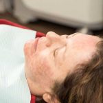 PRF Procedure Sheila